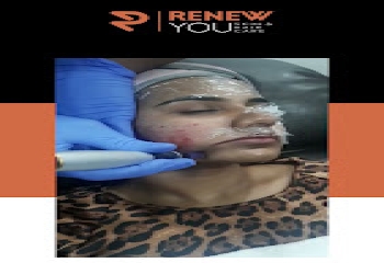 Renew-you-dermatology-clinic-Dermatologist-doctors-Sector-61-chandigarh-Chandigarh-2